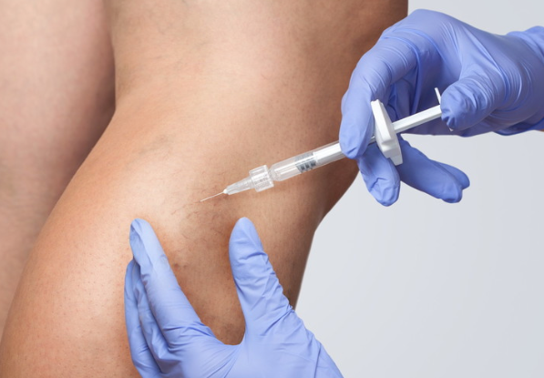 La scleroterapia